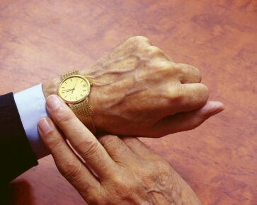 Náramkové hodinky na staré ruce - stáří - čas