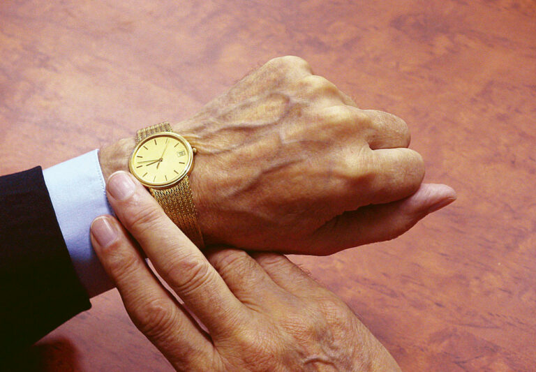 Náramkové hodinky na staré ruce - stáří - čas